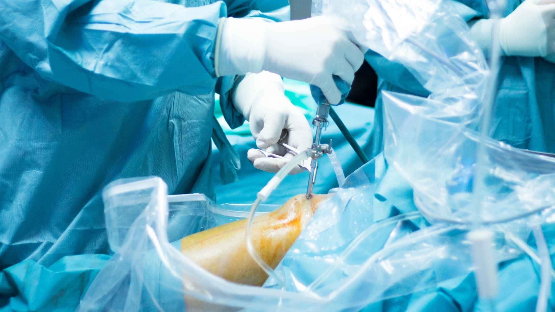 Navigated Knee Surgery