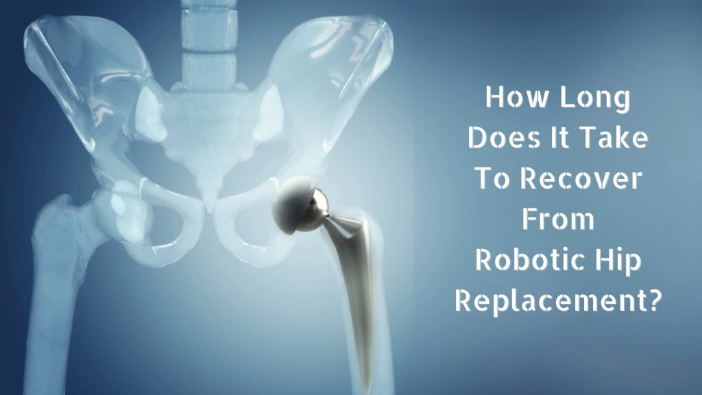 How Long Does It Take To Recover From Robotic Hip Replacement?
